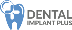 dental implants cheadle