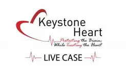 Keystone Heart - Tampa, FL, USA Keystone Heart - Tampa, FL, USA