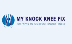 My Knock Knee Fix - Los Agneles, CA, USA