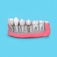 Adelaide Tooth Removals - St Peters, SA, Australia