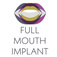 Full Mouth Implant - London, London E, United Kingdom